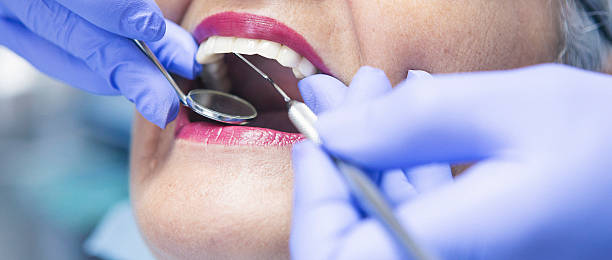 Best Chipped Tooth Repair Near Me  in Westway, TX